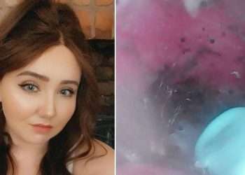 চিকিৎসক জানালেন বাসা বেঁধেছে মাকড়সা!