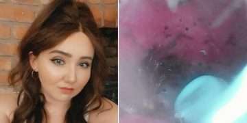 চিকিৎসক জানালেন বাসা বেঁধেছে মাকড়সা!