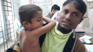 কুকুর ও বিড়ালের কামড়ে আহত ২ শতাধিক