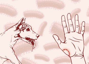 নতুন করে আতঙ্ক ছড়াচ্ছে প্রাণঘাতী জলাতঙ্ক