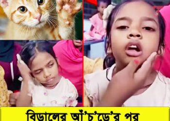 বিড়ালের আঁচড়ের পর শিশুর ‘মিউ মিউ’ শব্দ