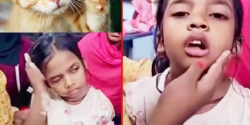 বিড়ালের আঁচড়ের পর শিশুর ‘মিউ মিউ’ শব্দ